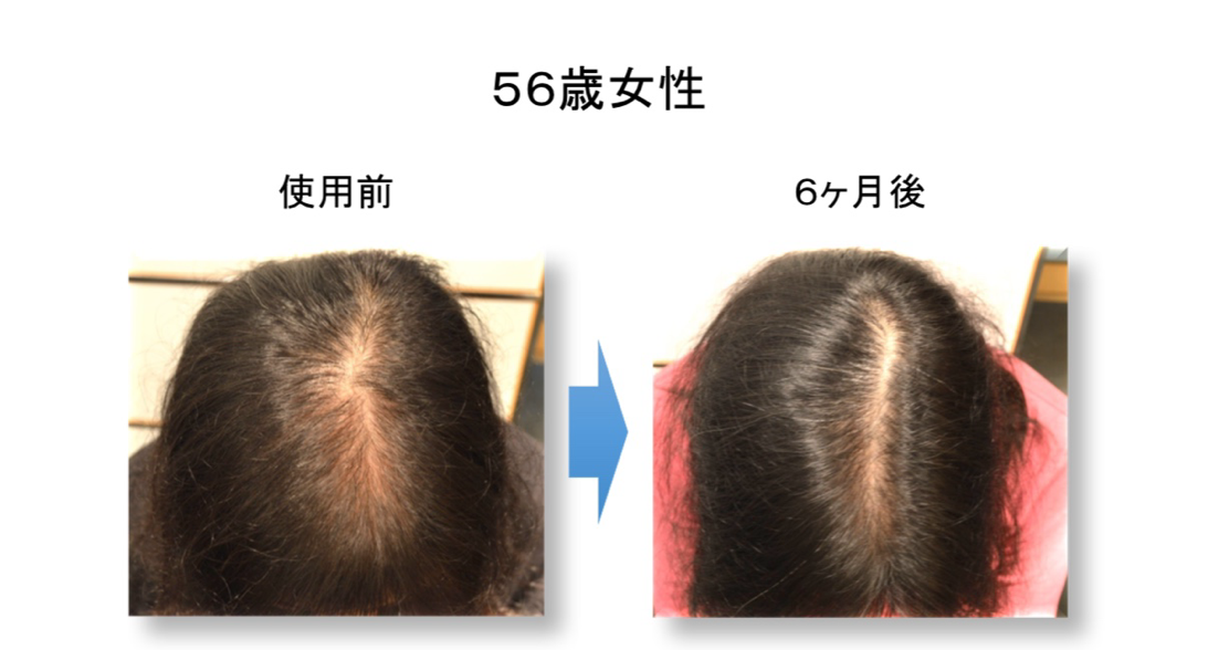 施術前 — 頭頂部