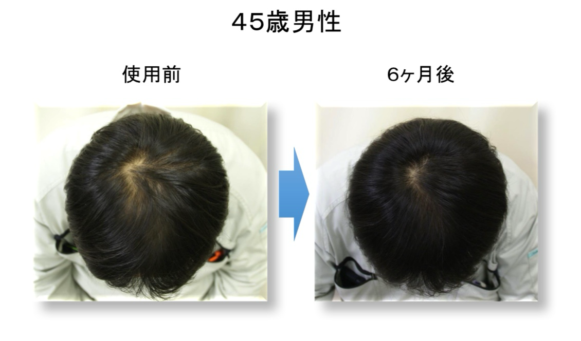 施術中経過