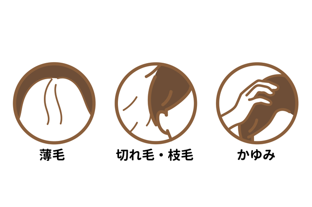 髪・頭皮のお悩み